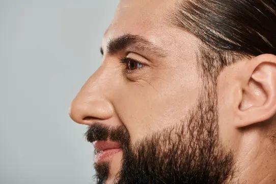 How Can Beard FUE Transplant Help Men Achieve a Fuller and Natural Beard in Kuala Lumpur, Malaysia?